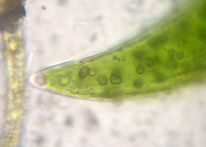 Closterium sp. (Closteriaceae)